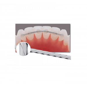 Flat Lingual RETAINER, Size .010" x .028" 6 inch (152mm) lengths PACK x 10